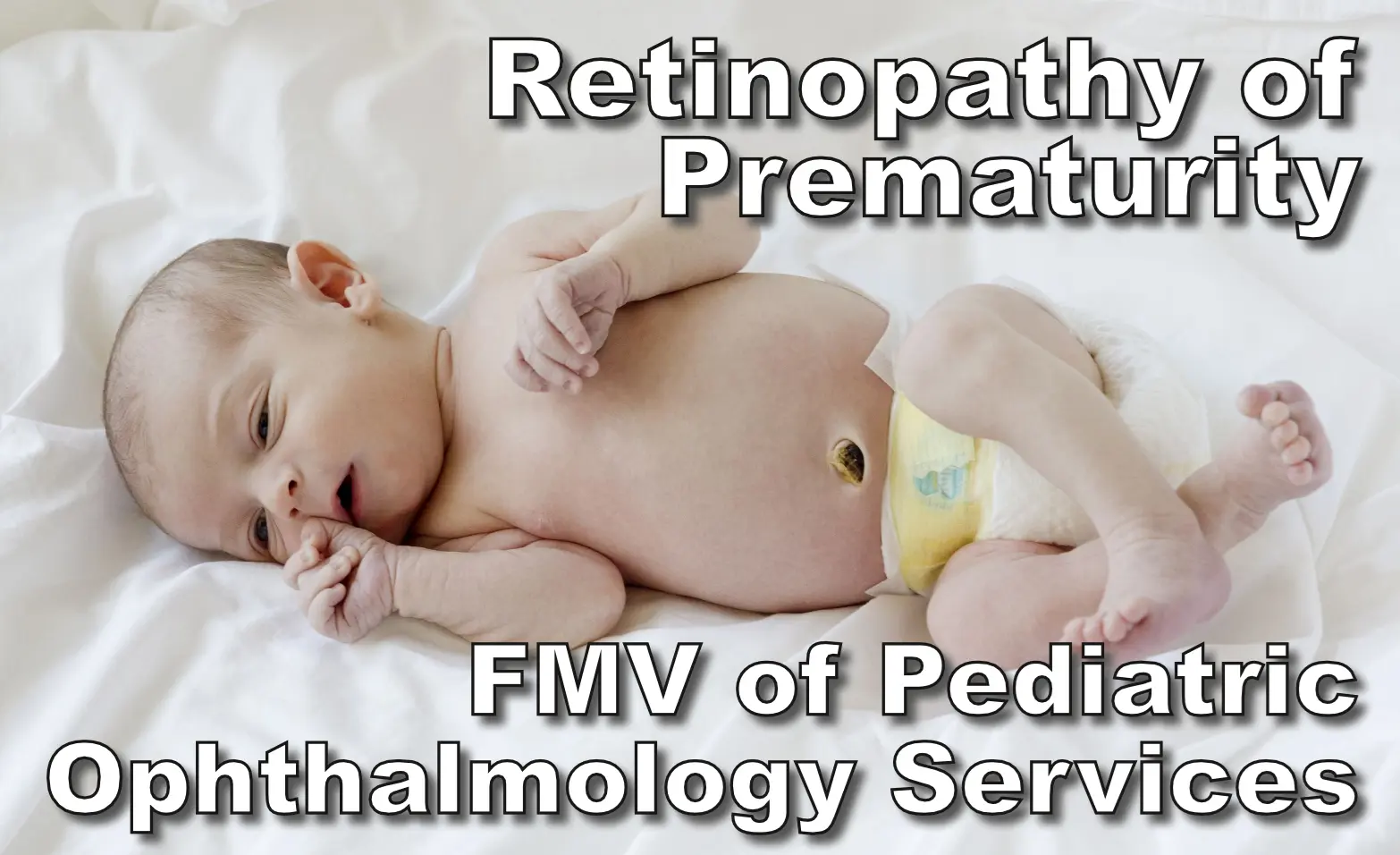 Retinopathy of Prematurity: FMV of Pediatric Ophthalmology Services
